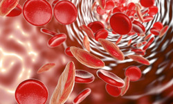 Czy osoby z anemią znajdują się w grupie ryzyka koronawirusa?