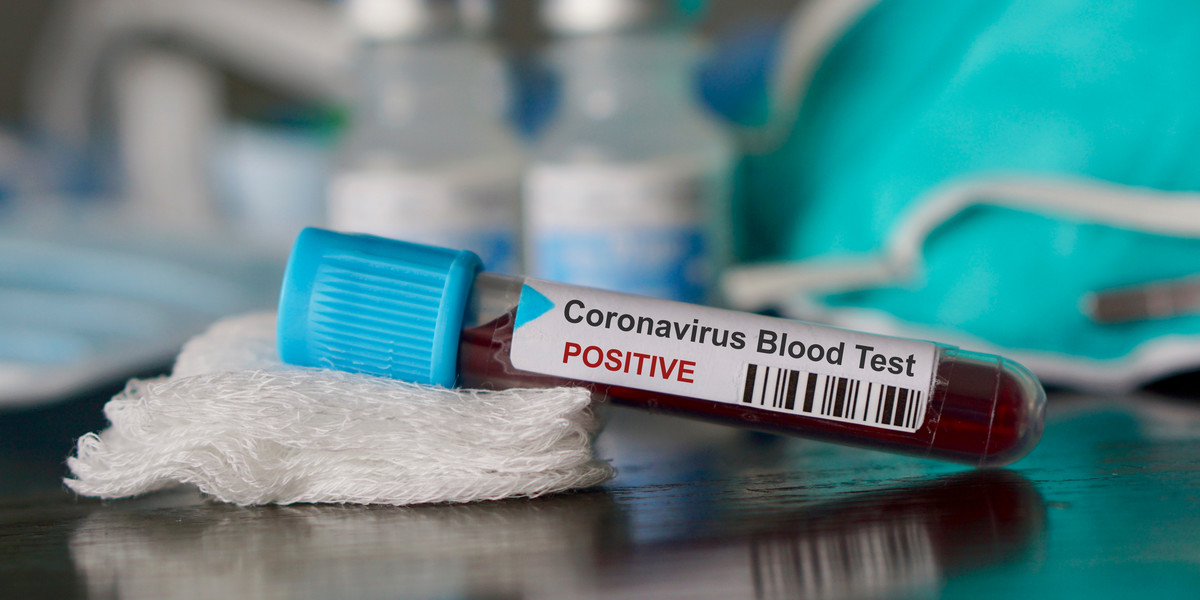 Instytut Kocha podał, że w ciągu ostatnich 24 godzin w Niemczech potwierdzono 687 nowych przypadków zakażenia koronawirusem.