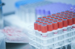 badania krwi pracownika – kiedy są obowiązkowe i od czego zależy ich z