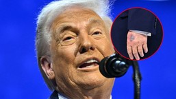 czy donald trump jest chory? nowe zdjęcia wywołały falę spekulacji o stan zdrowia