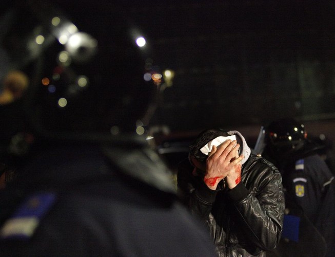 W poniedziałek rano trzy ranne w starciach osoby wciąż leżały w szpitalu