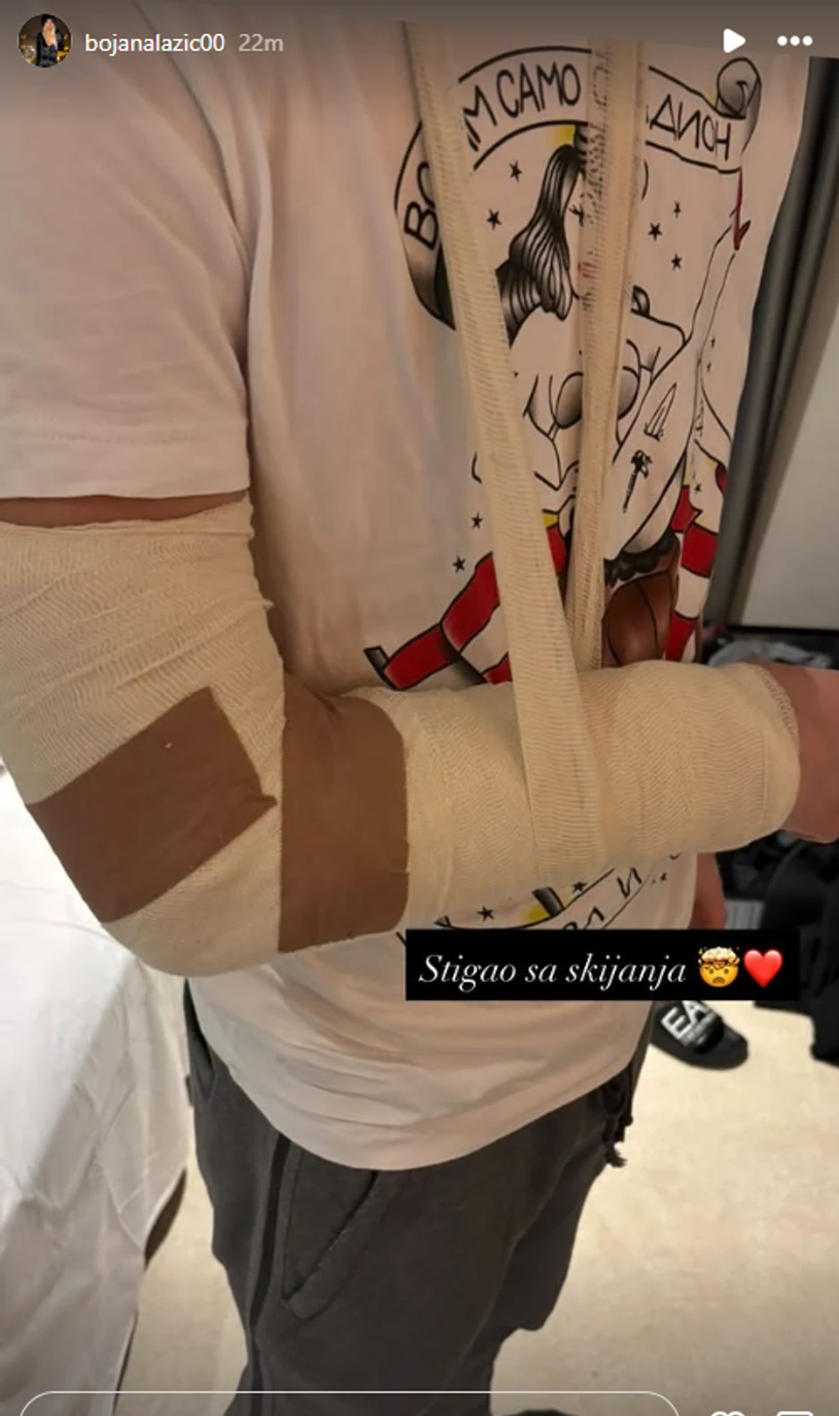 Sin Bojane Lazić se povredio na skijanju