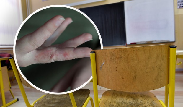 Šuga u vrtiću i školi u Beogradu, ilustracija 