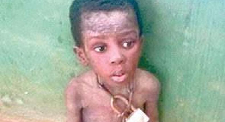 Malnourished boy, rescued by the authorities