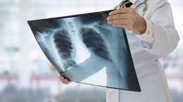 2,5 mln osób rocznie umiera na zapalenie płuc. Choroba najbardziej zagraża trzem grupom osób