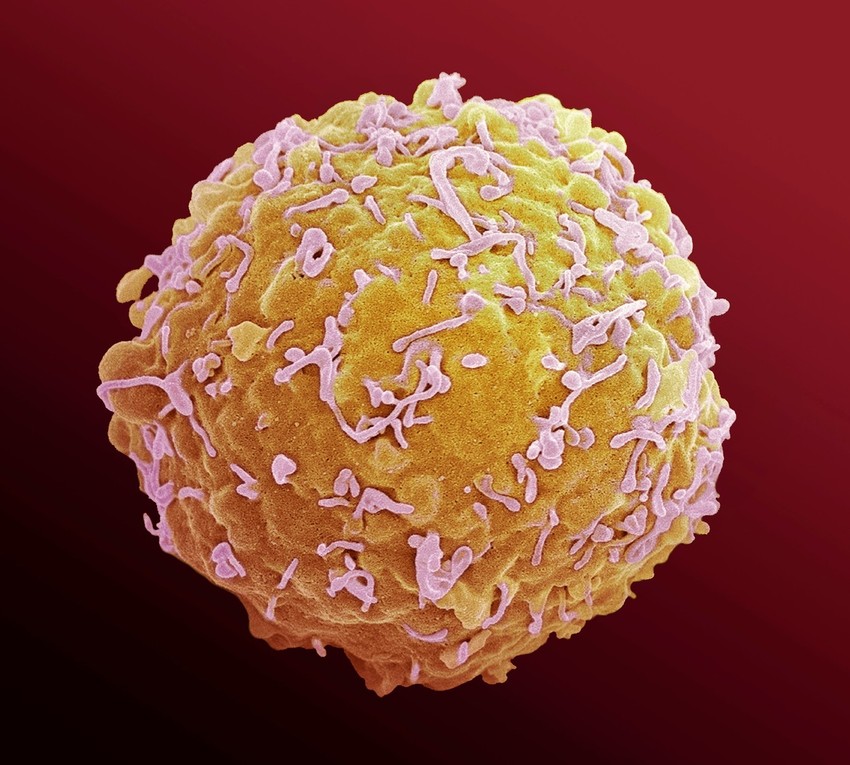 Ćelija imunog sistema