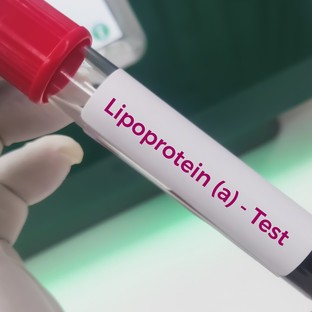 Magas lipoprotein(a)-szint: ezért fontos tudni az örökletes lipidzavarról
