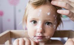 Gruźlica odporna na leki, odra, błonica, krztusiec i polio. Nowe zagrożenia