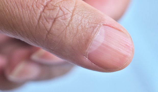 Polumesec na noktima