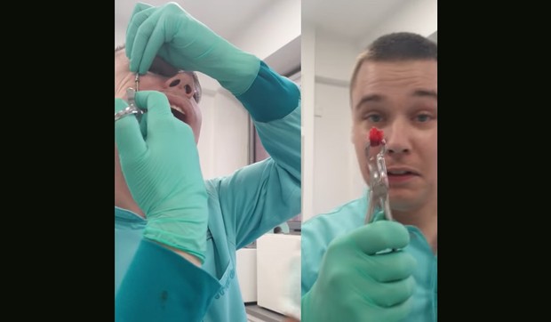 Strahinja Zrnzević, stomatolog iz Niša, sam sebi izvadio zub