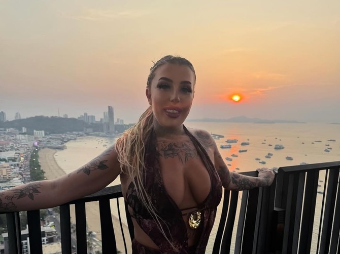 Influenserka Bet Klug pala sa terase hotela, slomila kičmu na 24 mesta, bore joj se za život