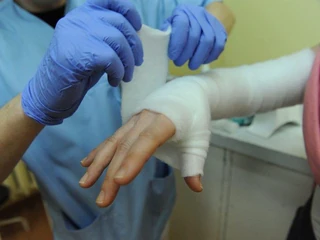 gips złamanie rehabilitacja służba zdrowia medycyna