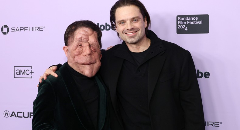 Adam Pearson costars with Stan in A Different Man.Matt Winkelmeyer/Getty Images