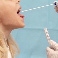 Koronavírus: ezekben az esetekben nem működik a nyálteszt