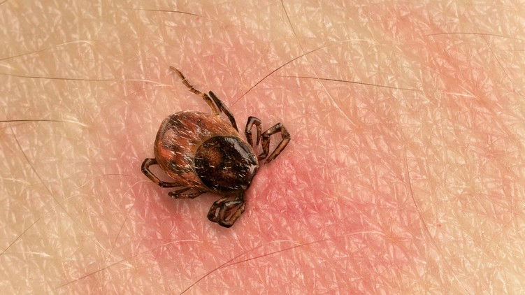 lyme-kór, kullancs, csípés, piros folt tünetek