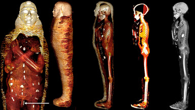 Mumia "Złotego Chłopca" zdradza swoje tajemnice