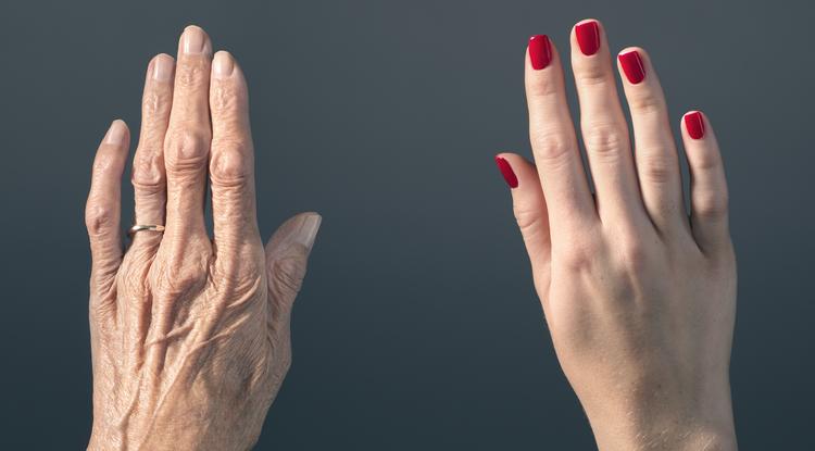 Így tehetsz az öregedő kézbőr ellen. Fotó: Getty Images