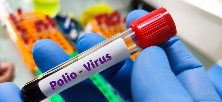 Przerażające informacje. W Warszawie wykryto zmutowany wirus polio