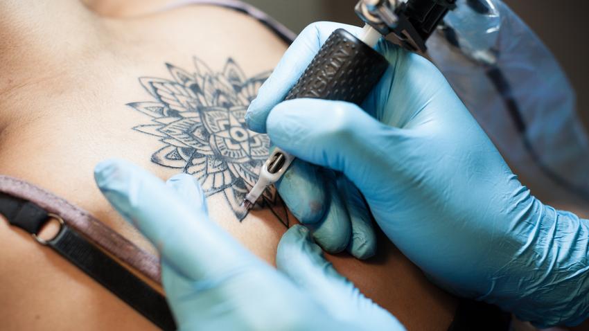 tetoválás veszélyei, bőrrák, fémérzékenység az orvos válaszol