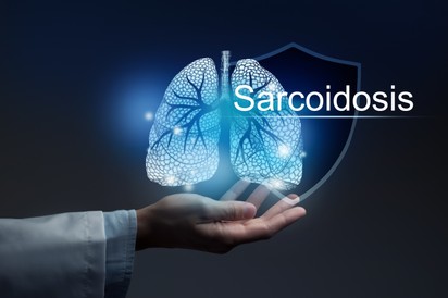 Szarkoidózis