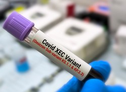 COVID-19 nie daje o sobie zapomnieć. Lekarka ostrzega: Nie oszczędza nikogo