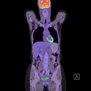 negativpetct-b-d0000016B53a0b97fe3e3