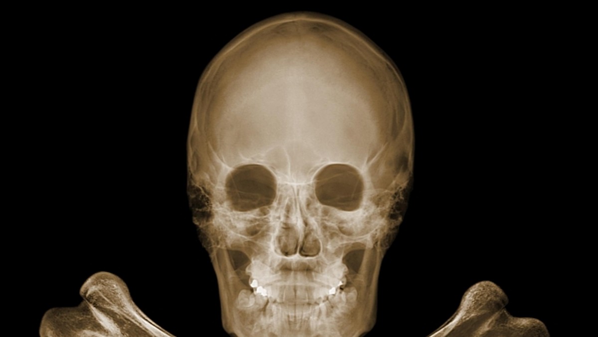 NICK VEASEY x-ray