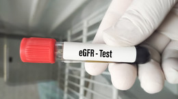 Jakie są normy eGFR? Diagnostka objaśnia