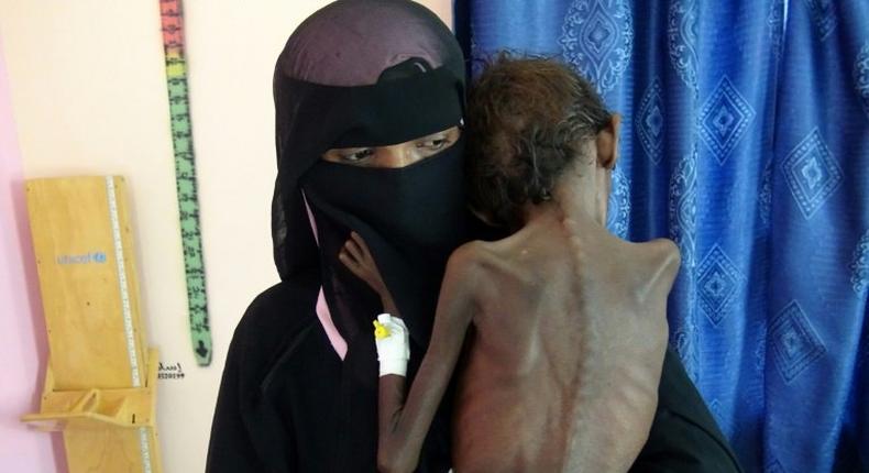 In Yemen, 14 million people stand at the brink of famine