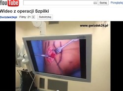Tak operowano polskiego boksera. Wideo dla ludzi o mocnych nerwach