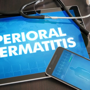 Periorális dermatitisz oka, tünetei és kezelése