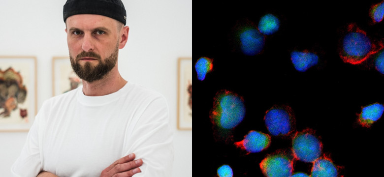 "Kup mojego raka". Artysta tworzy obrazy z... komórek nowotworowych. Cel jest prosty
