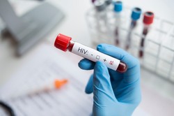 Przełom w HIV? Naukowcy twierdzą, że potrafią usunąć wirusa z komórek