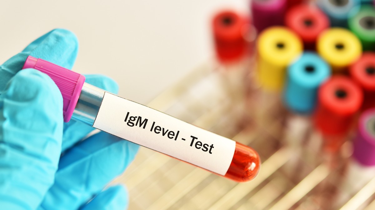 IgM antitela