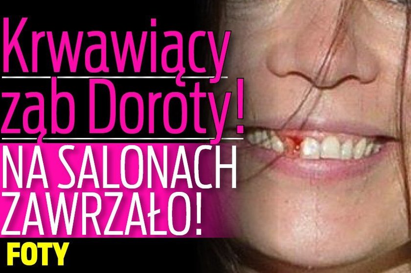 Krwawiący ząb Doroty! Na salonach zawrzało! FOTY