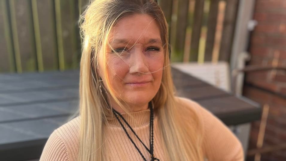 Ellen teraz nosí umelý nos.