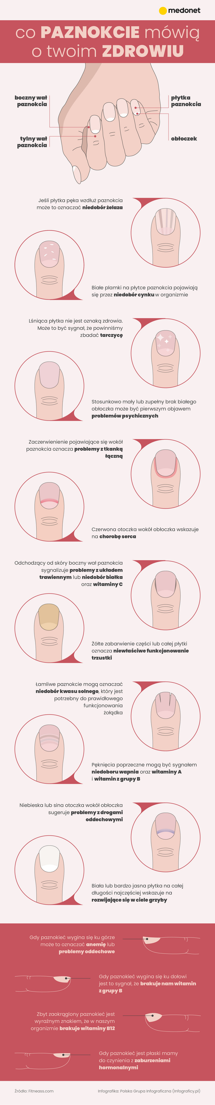 Co paznokcie mówią o zdrowiu? [INFOGRAFIKA]