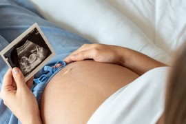 Ove TRI GODINE su NAJBOLJE ZA TRUDNOĆU! Kvalitet jajnih ćelija tada je na maksimumu, i master i posao mogu da sačekaju,  poručuje doktorka Biljana Živaljević