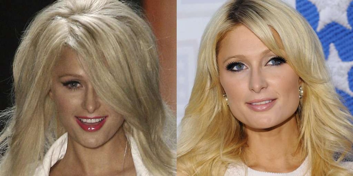 Szok! Paris Hilton łysieje?