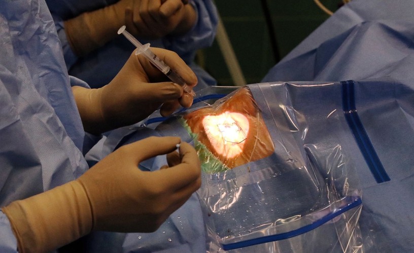 OPERACJA ZAĆMY W 3D. NOWOCZESNY SPRZĘT W WARSZAWIE