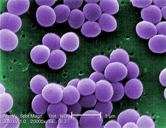 Staphylococcus aureus