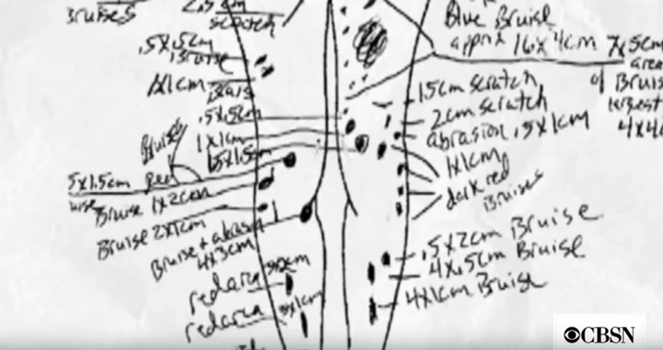 Povreda nije bilo samo na pozadini nogu i temenu