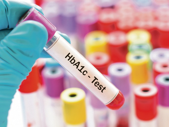 DIJAGNOZA HbA1c TEST dijabetes