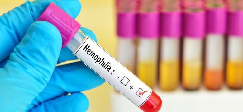 Nowe możliwości terapeutyczne dla dzieci z hemofilią. Co to oznacza dla małych pacjentów?