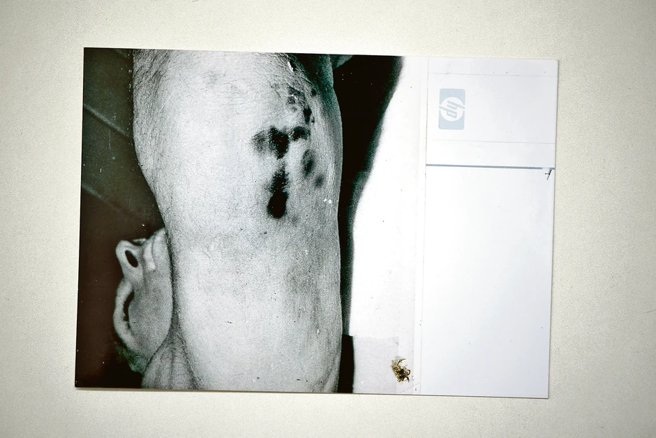 Milos Milosević, autopsija