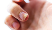 Co lekarz może "wyczytać" z twoich paznokci? To dlatego uważnie im się przygląda