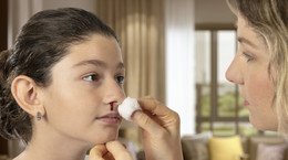 Krwotok z nosa u dziecka - przyczyna problemu i pierwsza pomoc. Jak zatamować krwawienie?