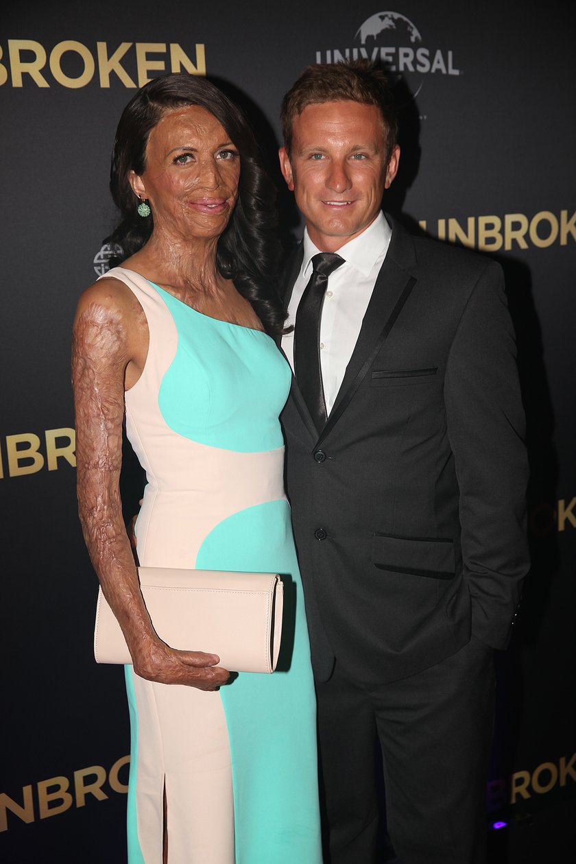 Turia Pitt