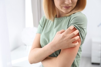 Ekcémás, és folyton viszket a bőre? Így csökkentheti az irritációt