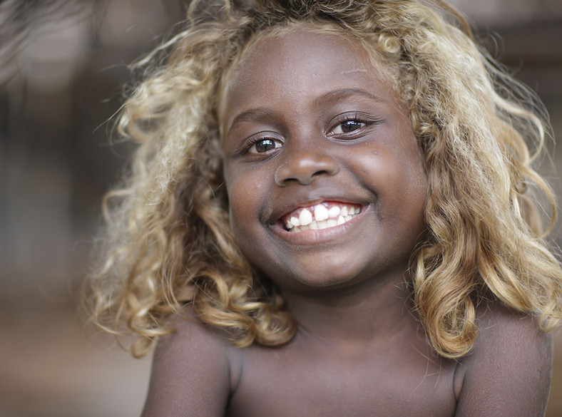 Melanesians Meet The Worlds Only Natural Black Blondes Gh 6320